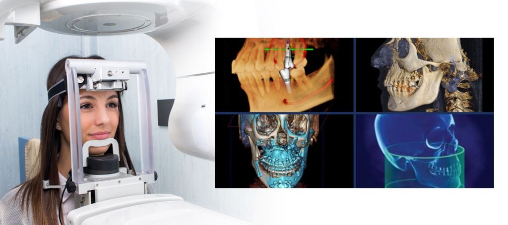 To better treat our patients’ teeth, we bought the best equipment – Ct scan dental